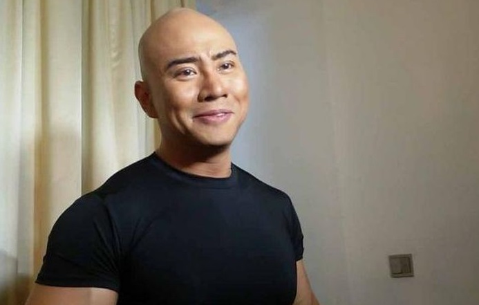 Innalillahi Deddy Corbuzier Ngaku Matanya Sempat Nyaris Buta Akibat Ada Besi Yang Nancep Di Kepalanya Ini 12 Jahitan Sedang Viral